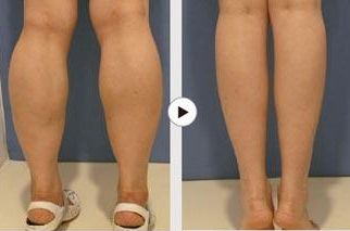 金華去痘印哪家醫(yī)院好？淺談金華地區(qū)專業(yè)的去痘印醫(yī)療機構