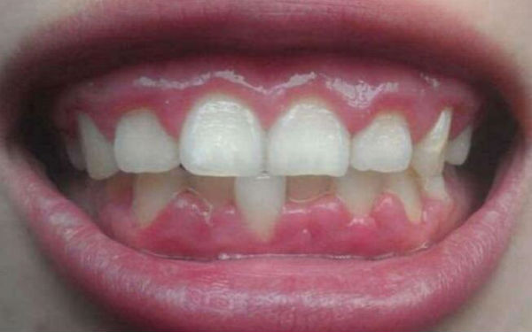 2023南昌口碑炙手可熱的微調(diào)下頜角整形醫(yī)院Top10，你了解多少？