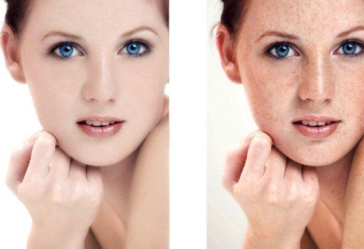 揭秘杭州哪家醫(yī)院能有效去除曬斑，為您推薦專(zhuān)業(yè)治療方案