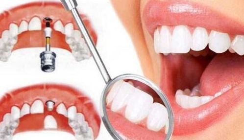 西寧雙眼皮效果好的醫(yī)院有哪些？