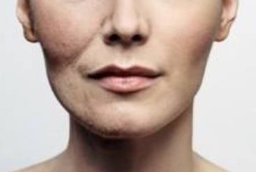 膠原蛋白是祛皺的果真有效嗎？