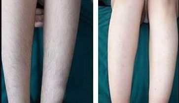 長(zhǎng)春微整形醫(yī)院哪家技術(shù)好且口碑好？