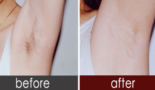 淮北哪家醫(yī)院雙眼皮效果好？找到最適合您的醫(yī)院