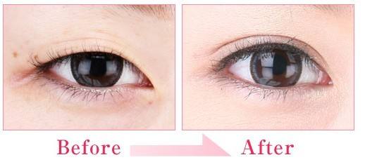 重慶哪家醫(yī)療美容醫(yī)院效果比較好？2023年重慶激光祛除紅胎記排名榜top10權(quán)威醫(yī)院大揭秘！