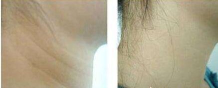 烏魯木齊眼科綜合哪家醫(yī)院好？專家告訴你最權(quán)威的選擇！