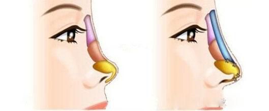 武漢市做雙眼皮哪家好？-經(jīng)驗(yàn)豐富的專業(yè)整形醫(yī)院推薦