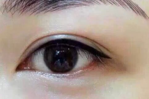 濟(jì)南眼睛手術(shù)哪家醫(yī)院好？濟(jì)南專業(yè)眼科醫(yī)院排名解析