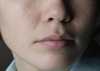 2023年青島十佳醫(yī)療整形醫(yī)院排行榜出爐，祛痣效果哪家比較好？