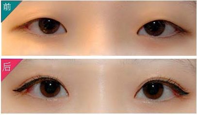 成都比較優(yōu)秀的隆鼻整形權威迎來巔峰表現(xiàn)！醫(yī)術高超技能卓越提升！