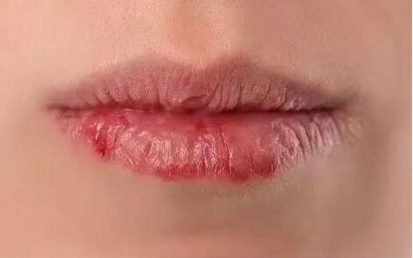 蘇州哪里的眼袋整形手術(shù)效果好？一文匯總，通通揭秘！