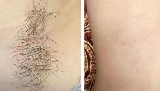 蚌埠私密整形哪家醫(yī)院好？選擇私密整形醫(yī)院時(shí)需注意哪些因素？