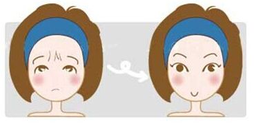 雙眼皮手術(shù)術(shù)后能喝菌湯嗎？注意事項有哪些？追加疑問式標(biāo)題：菌湯有助于雙眼皮手術(shù)恢復(fù)嗎？