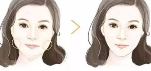 上海鼻子矯正哪家醫(yī)院好？了解上海鼻子矯正費(fèi)用和手術(shù)效果的綜合分析