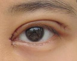 楊怡有沒有進(jìn)行整容手術(shù)？近期關(guān)于她的整容傳聞揭秘