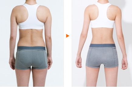 銀川熱瑪吉哪家做得好？揭秘銀川市熱瑪吉醫(yī)療美容機構排行榜！