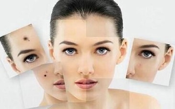 如何快速去除痘痘？學(xué)習(xí)這些小竅門吧！