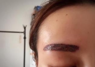 荊州太陽(yáng)穴填充口碑好整形醫(yī)院大盤點(diǎn)