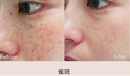 成都胸部整形醫(yī)院哪家最靠譜？