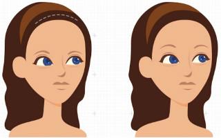 豐唇用玻尿酸一針價格如何？手術后該如何進食