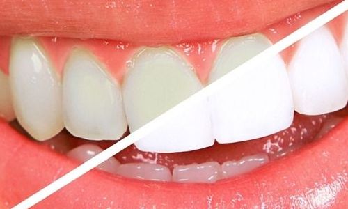 廣州激光整形醫(yī)院排名2023年最新評比，哪家好？