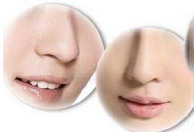 彩光脫毛會(huì)導(dǎo)致副作用嗎？真人體驗(yàn)如何？