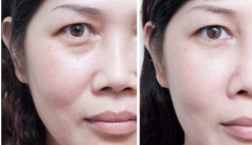 廈門做鼻子手術哪家醫(yī)院好？