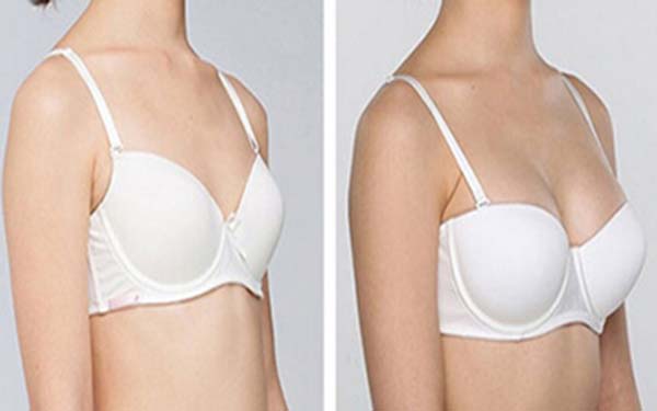 眼角紋的形成原因是什么？如何有效去除？