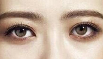 假體隆胸和注射隆胸哪個更適合？優(yōu)缺點對比后該如何選擇？