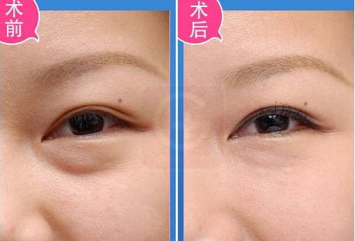 溫州哪家醫(yī)院做整形好？整形醫(yī)院排行榜解析