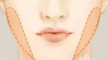 金在中整容前后對比圖，你會相信這是同一個(gè)人嗎？