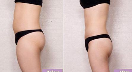 無(wú)錫眼睛整形醫(yī)院哪家好？教你如何選擇無(wú)錫最靠譜的眼部整形醫(yī)院