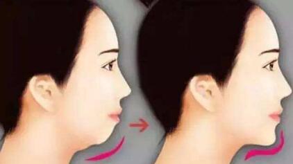 假體隆鼻手術(shù)操作原理是否有效？效果如何？