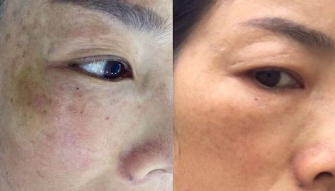 瀘州狐臭手術(shù)哪家醫(yī)院好？選擇時(shí)需關(guān)注的重要因素有哪些？