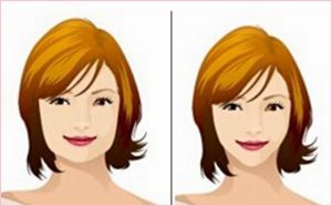 手臂吸脂術(shù)術(shù)后需要注意哪些事項？手臂吸脂術(shù)的效果如何呢？