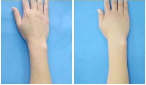 唐山哪家醫(yī)院去眼袋好？2023年最新排名推薦，專家為您解讀！