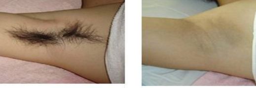 上海微整容醫(yī)院哪家好？為您推薦上海微整容醫(yī)院排行榜