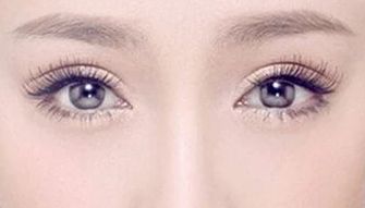 林珍娜整容后，煥然一新，她的變化令人驚嘆！