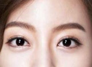 黑眼圈嚴(yán)重是什么原因引起的？如何消除眼部問(wèn)題？