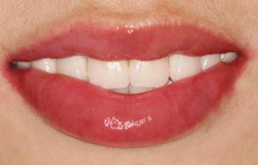 泰安第四人民醫(yī)院激光美容整形科醫(yī)院團隊的技術(shù)怎么樣？整形科醫(yī)生水平如何？