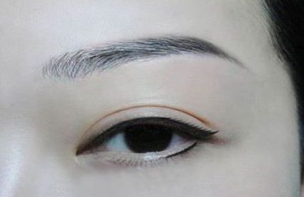 東莞哪家割雙眼皮醫(yī)院排第四？維多利亞醫(yī)療美容不是唯一選擇