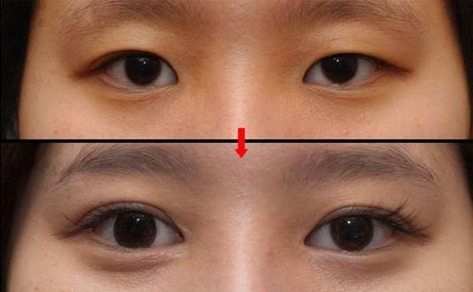 2023杭州大腿抽脂吸脂高推薦度醫(yī)院排名，十大醫(yī)美中心等你選！