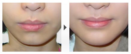 沈陽皮膚美容醫(yī)院排名TOP10，哪家好？