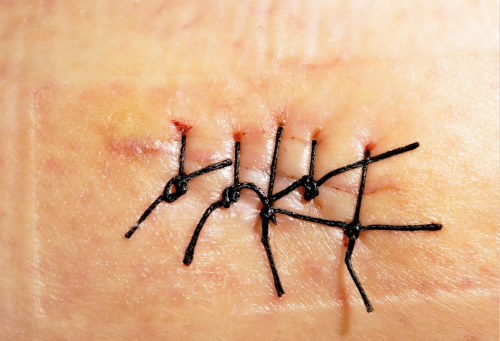 東方整形醫(yī)院的價(jià)格表在重慶可以通過哪些途徑免費(fèi)查詢？有哪些醫(yī)生可以提供專業(yè)的整形美容咨詢服務(wù)？