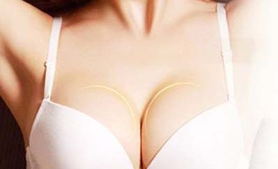 標(biāo)題：換個角度，欣然接納整容手術(shù)的魅力！