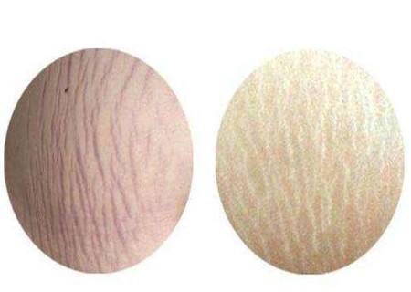 男模時詩整容前后是否曝光？驚艷巨變令人震撼嗎？