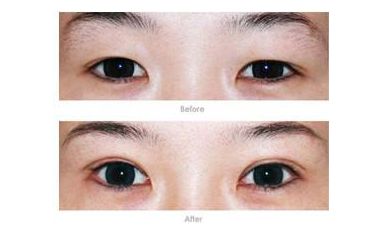 上海翼鼻塑形醫(yī)生李青峰、戴傳昌等8位專家堪稱行業(yè)瑰寶