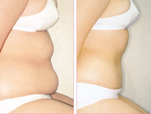 南京哪家醫(yī)院的緊膚除皺效果最好？