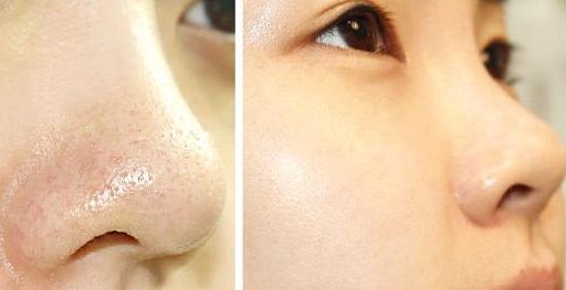 廣州假體隆胸哪家品質(zhì)好？如何選擇最佳廣州假體隆胸醫(yī)院？