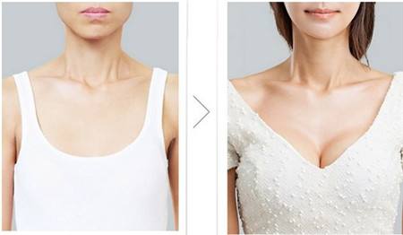 平扇形雙眼皮適合什么臉型？做這種雙眼皮需要花多少錢呢？