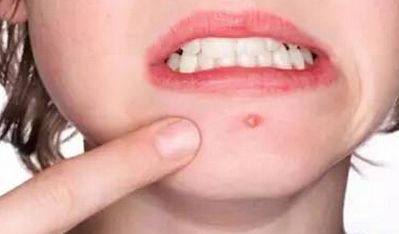 2023上海專業(yè)面部提升醫(yī)生推薦！專家親自解讀！